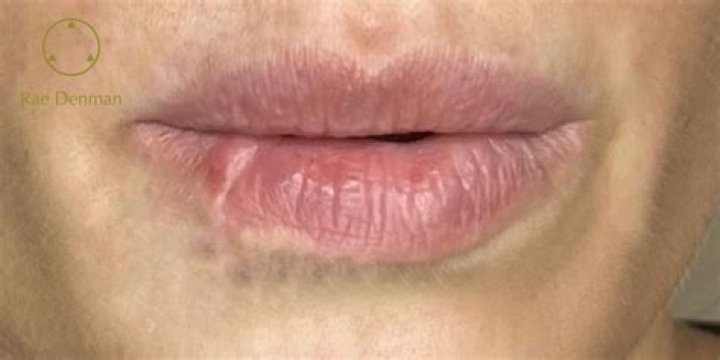Uncover The Intriguing Truth Behind Gabriel Macht's Scar Lip