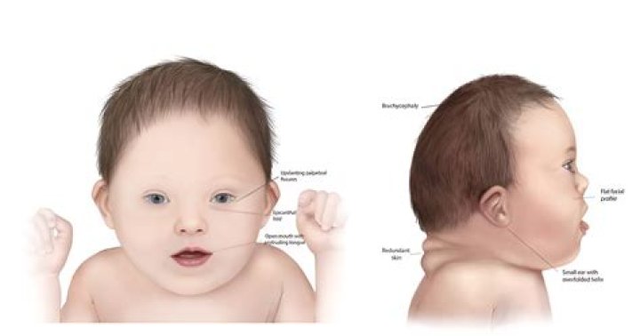 Uncovering George Clooney's Parenthood And Down Syndrome