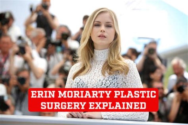 Unlocking Bonnie McMurray's Plastic Surgery Enigma: Discoveries And Insights
