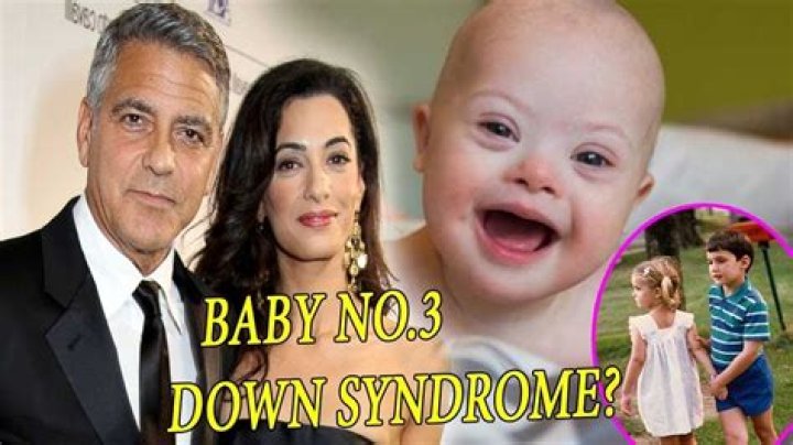 Unveiling The Extraordinary Journey Of George Clooney's Son With Down Syndrome