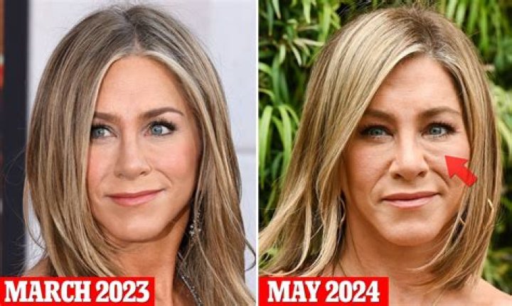 Unveiling The Truth Behind Jennifer Aniston's Plastic Surgery Rumors